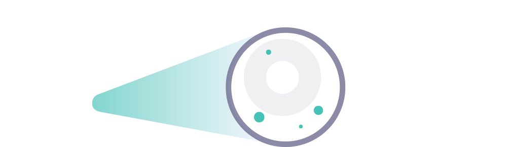 Normal Lysosome